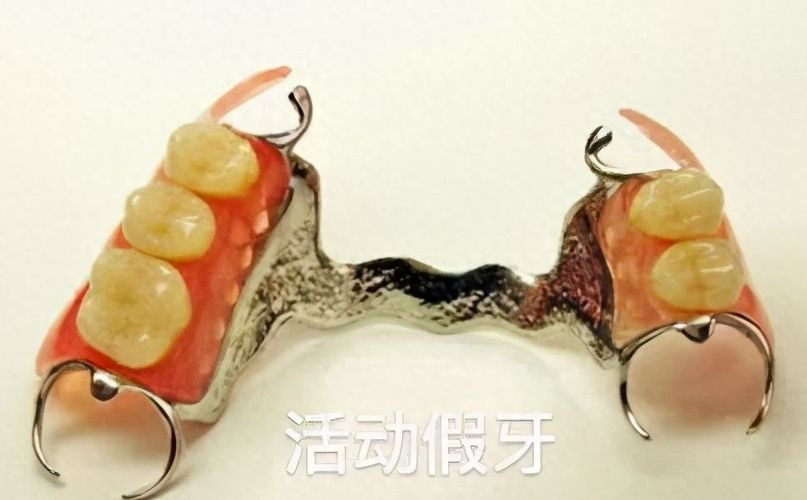 华南地区海口茹家口腔服务费用公开！秀英区种牙价格实惠，快来看看！