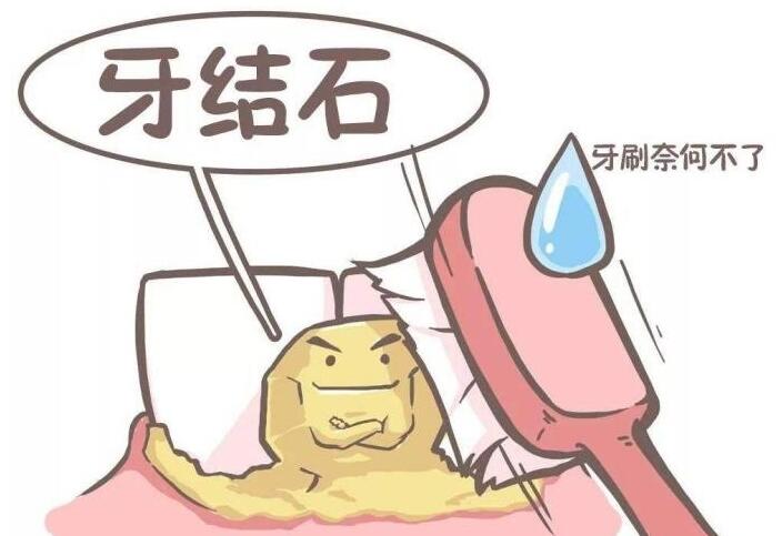 成都团圆口腔：了解全口种植牙价格，满足您的牙齿需求
