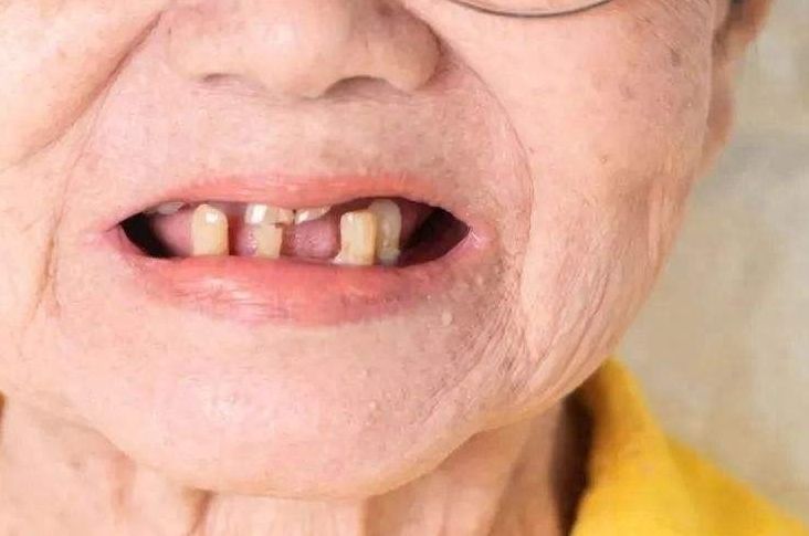 重庆博仕口腔：牙齿修复费用、价格及方案解析