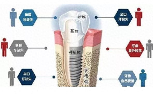 洛阳牙齿清洁价格查询，友好口腔优惠活动详解
