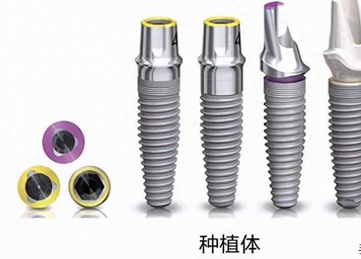 重庆江北牙卫士口腔医院收费优惠信息揭秘