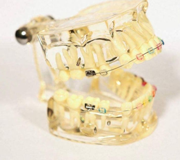 成都华誉口腔：价格表、环境、资质全揭秘！看看真实种植牙案例