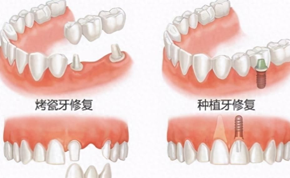常州丽洁口腔门诊部用户评价如何？专业技术与合理价格得到广泛认可！