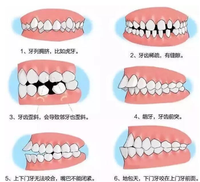 清远市清城区这家牙科实施瑞士种植牙优惠活动，免1颗费用致敬您的美笑