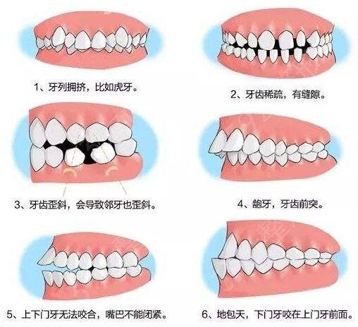 北京优颐口腔医院口碑好吗？种植牙的费用是多少？