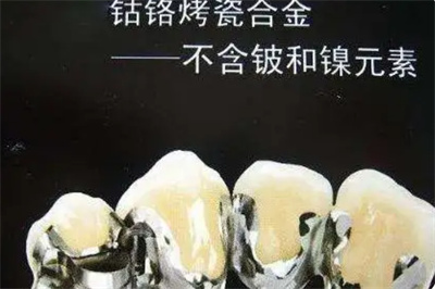 上海东奥口腔：牙齿矫正价格实惠，顾客好评如潮！
