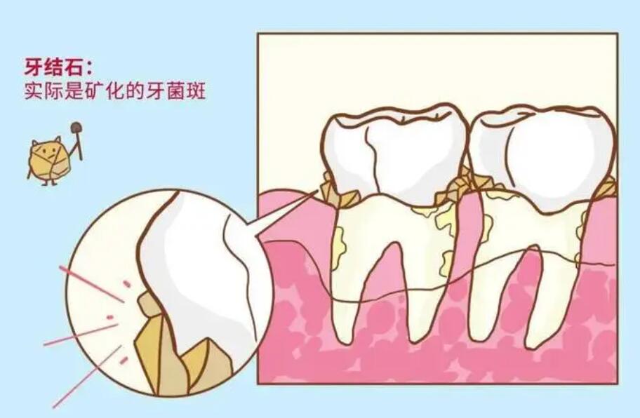 石家庄中诺口腔预约电话公开! 快速咨询中诺口腔活动价格，专业解答！