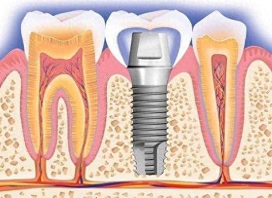 珠海暨博口腔医院-环境、医疗团队、费用全方位评估