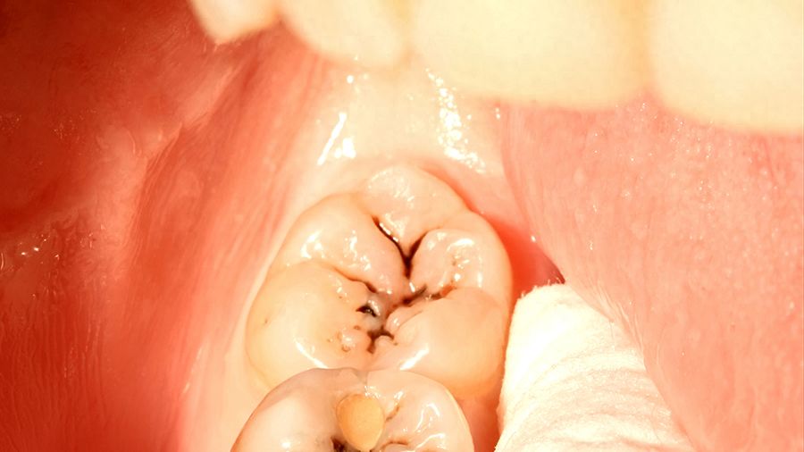 北京海德堡口腔的收费如何？口碑如何比较？