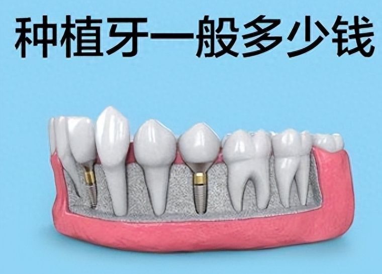 十堰东风口腔医院如何？综合评析医院概况与费用