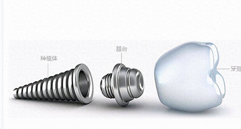 江苏镇江泽康口腔诊所好不好？技术专业，价格实惠