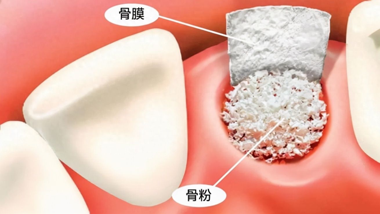 烟台华怡牙齿矫正费用查询