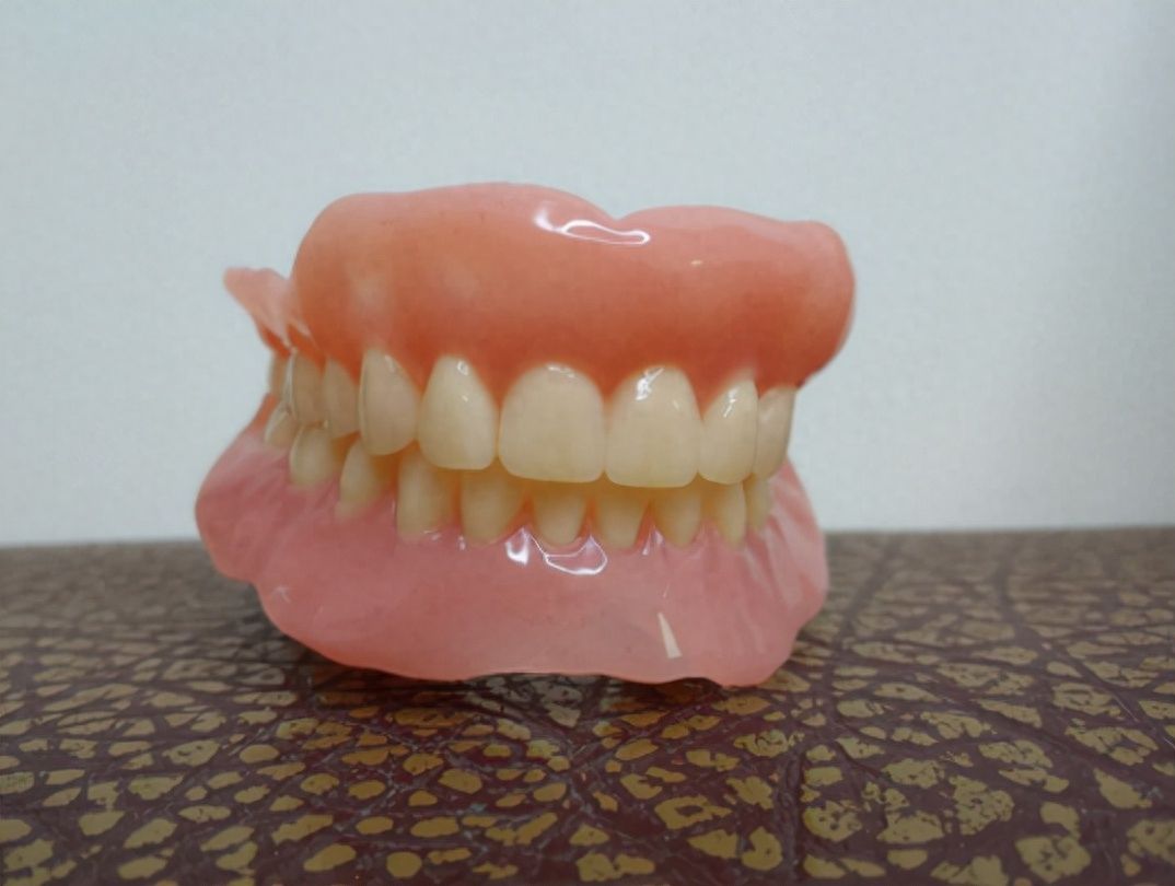 南京口腔种植费用如何？