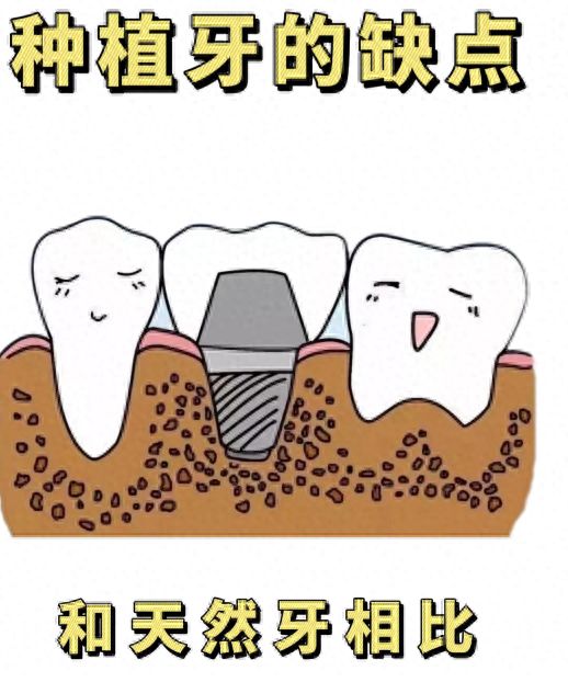 无锡维乐口腔种植牙费用大揭秘，韩国、瑞士价格优势瞩目！