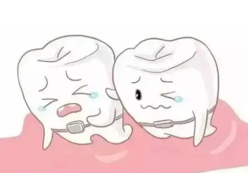 暑期来成都君臣口腔，低价享受传统金属托槽矫正服务，仅需4980元