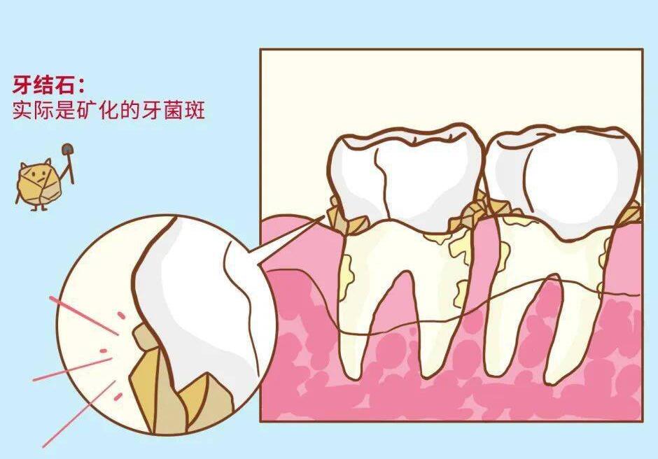 乌鲁木齐美奥口腔医院口腔价格表，了解种植牙、正畸、贴面、补牙费用