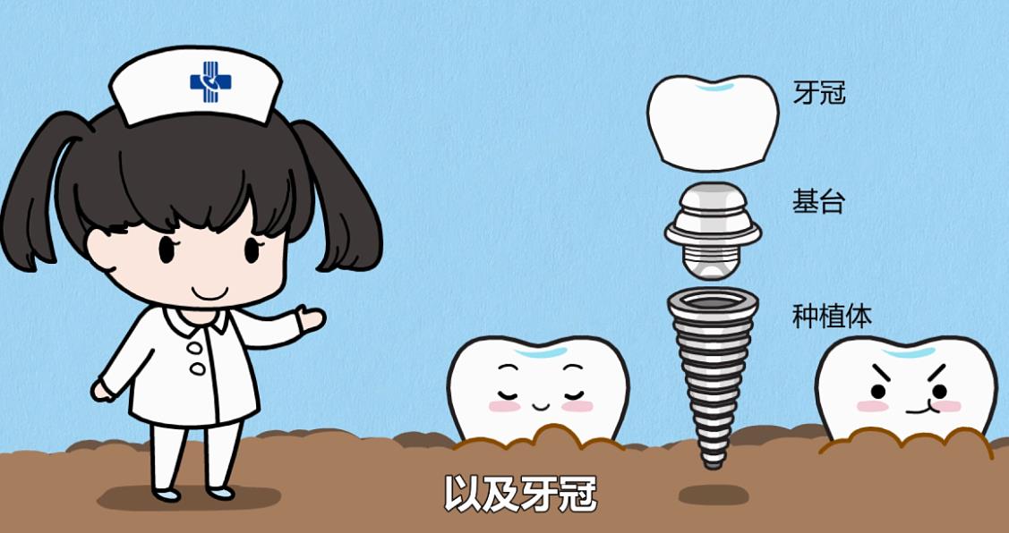 南通种植牙价格2024年多少？种牙费用明细下降，只需2880起