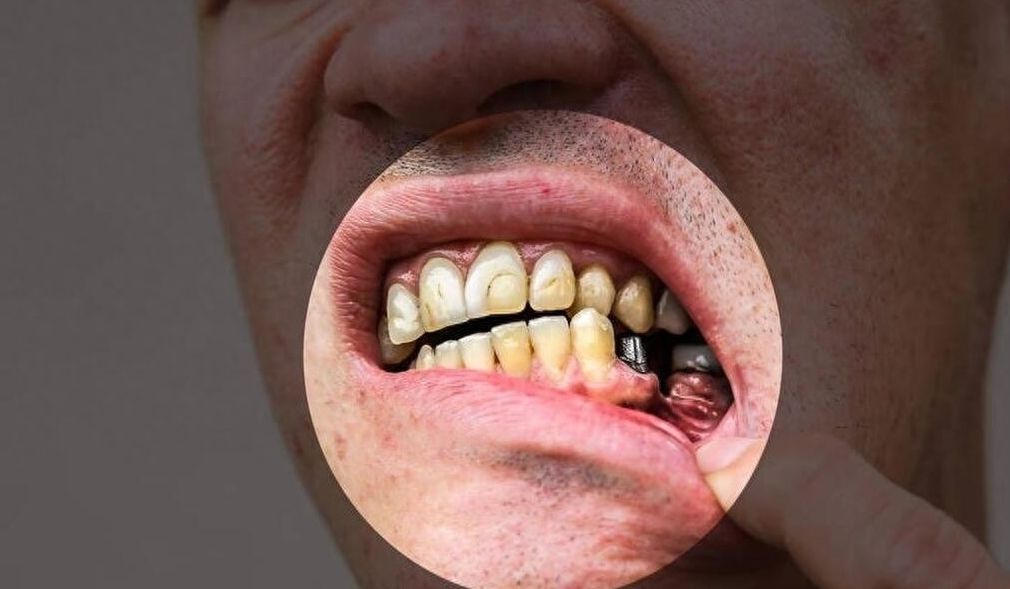 南昌辉煌口腔隐形矫正的价格及地址