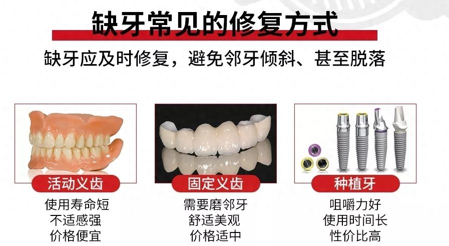数字化种植牙价格曝光，让您轻松掌握牙齿种植成本