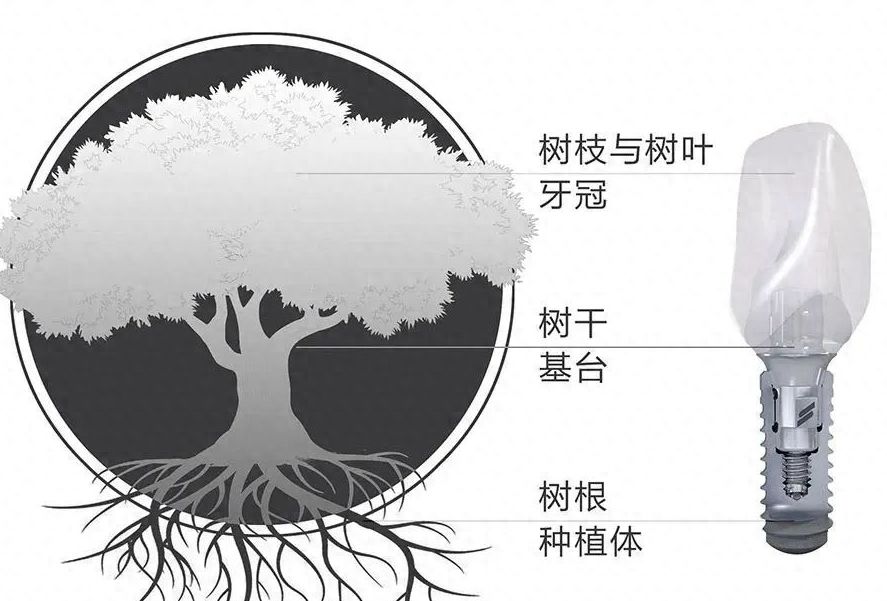 成都锦江牙齿矫正价格如何