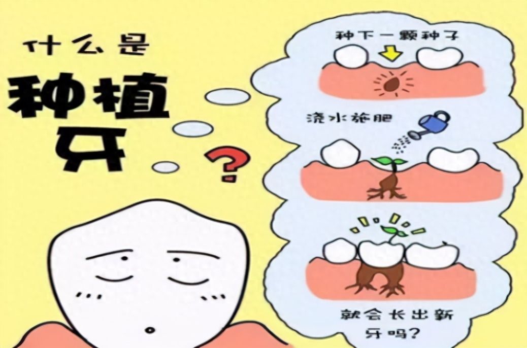 杭州薇琳口腔：种植牙价格揭秘！最低单颗3980元，半口仅需37600元