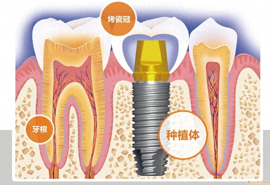 阜城安康牙科智齿拔除费用因位置各异，价格区间广泛