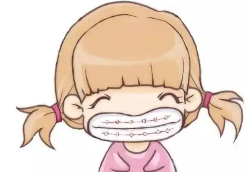 北京超声波洁牙的收费是多少？