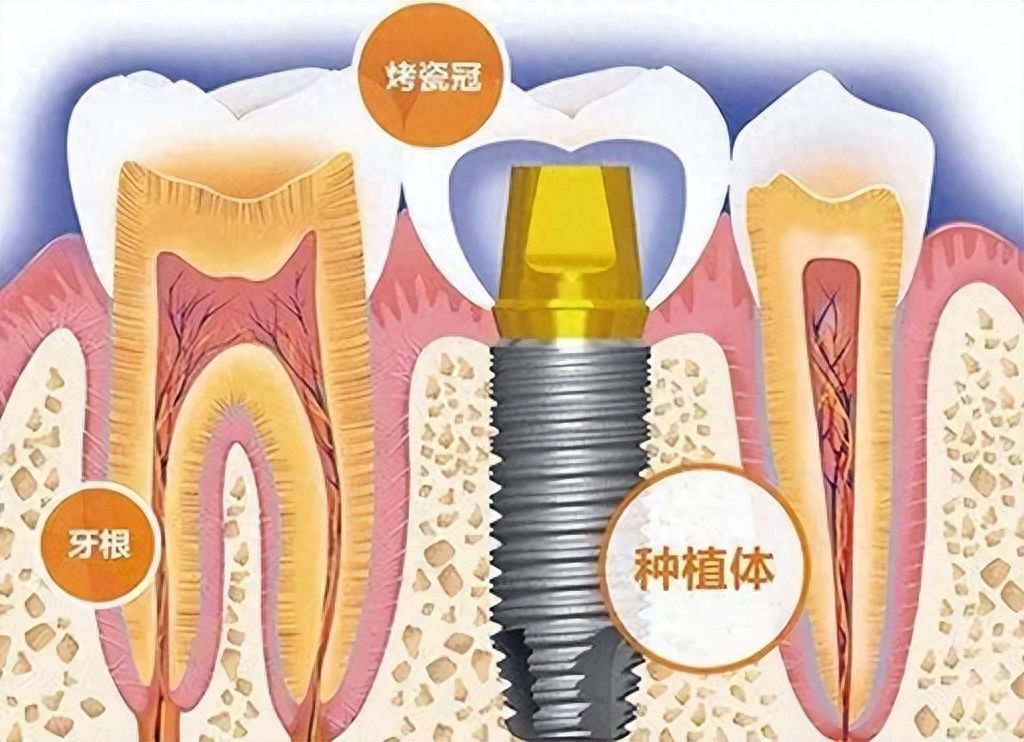 江阴大熊先生口腔医院收费价格公开透明，用户评价口碑优良