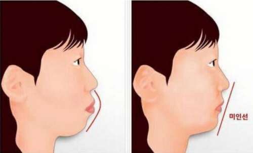 北京顺德口腔：种植牙技术优秀，价格实惠，正规口腔诊所