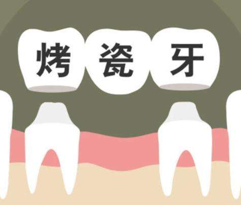 广州穗华口腔：种植牙价格及正规认可如何？