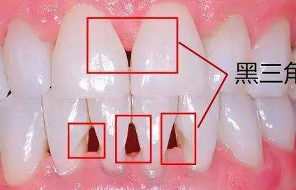 绵阳公立医院箍牙价格高达3万？为何绵阳箍牙这么昂贵？