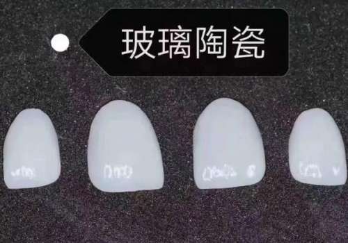 合肥贝杰口腔医院种植牙价格查询！详细盘点种牙费用