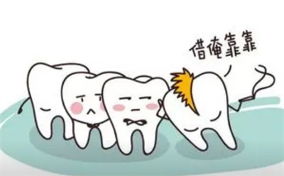 口腔瘘管的治疗方式和费用，你需了解