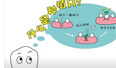 深圳着名医院种植牙收费及实力解析，选择理想口腔医院全攻略！