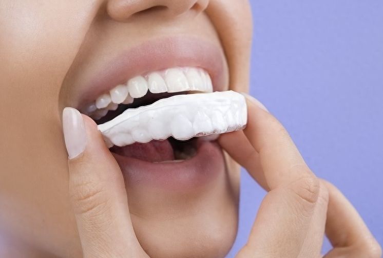 瑞泰口腔的价格真的很实惠吗？