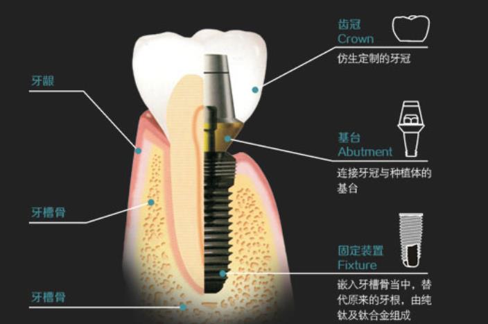 郑州口腔价格公示，请看！