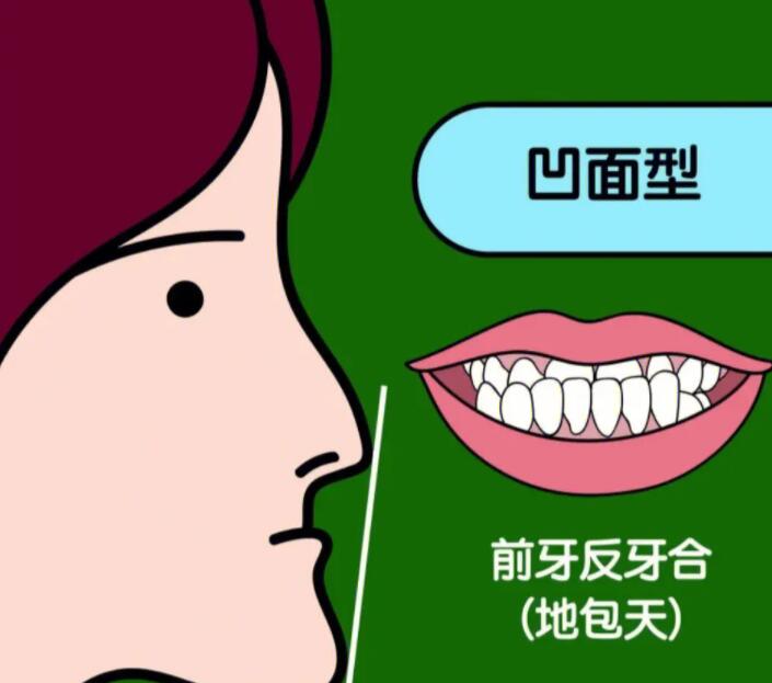 暑期牙齿矫正优惠！深圳韦博口腔超值大礼包等你来领！