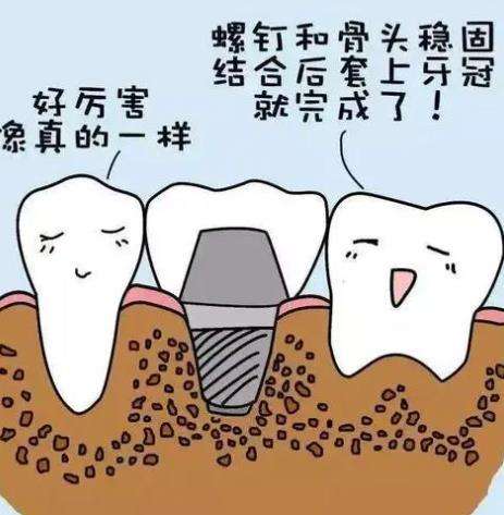 扬州贝恩口腔：补牙费用参考，树脂、嵌体补牙价格有所了解