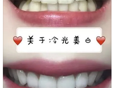 成都圣贝口腔5.1特惠活动震撼来袭，无需担心种植牙和矫正的高昂费用