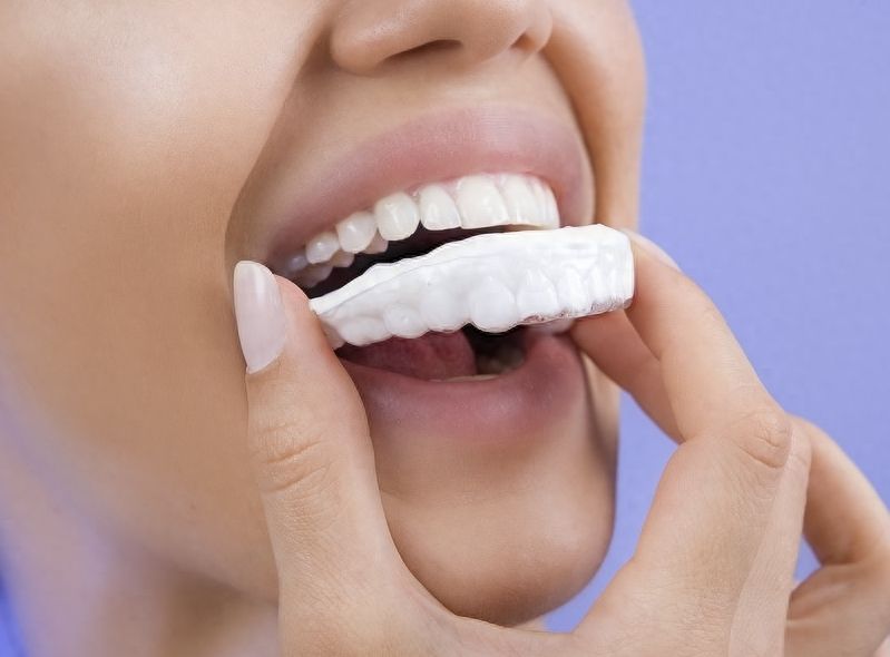 孩子矫正牙齿，多少钱合适？