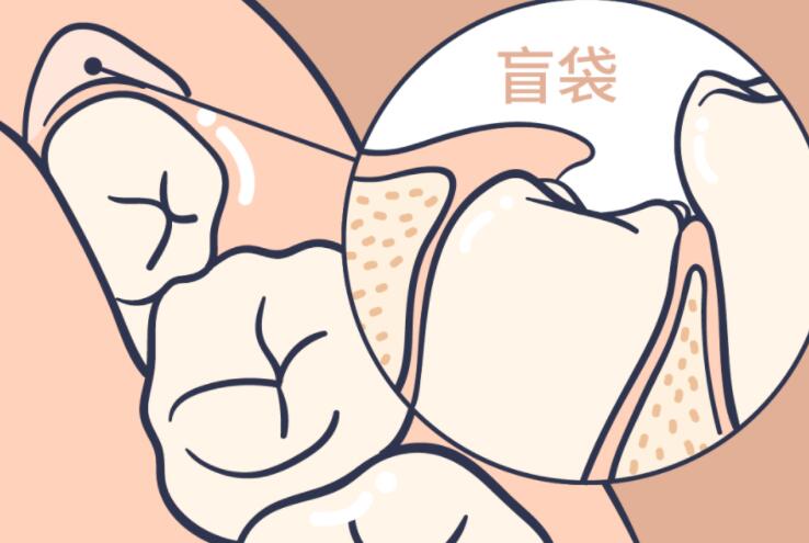 西安中诺口腔种牙价格表详解，收费公道吗？