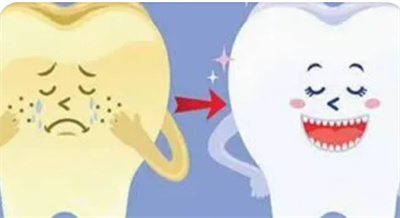 北京薇琳口腔种植牙价格多少？