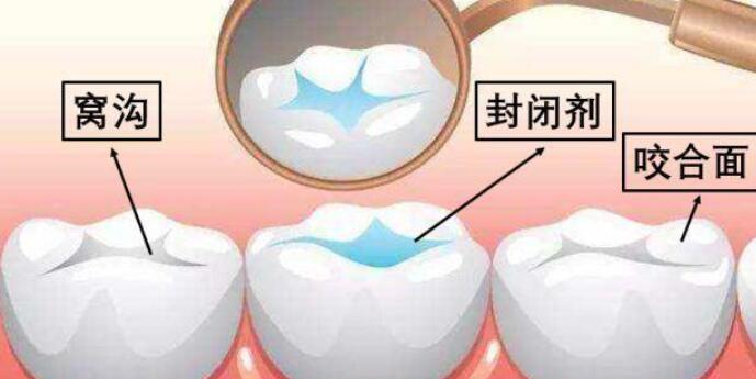 利美康口腔：种植牙价格揭秘，轻松预算口腔项目收费