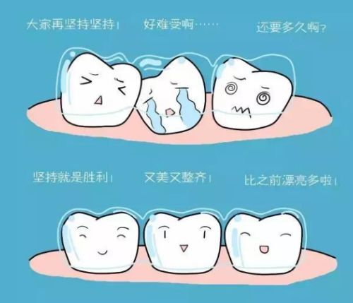 广州市民！优惠给你的矫正器价格公开了