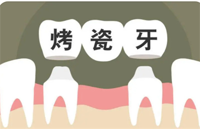 深圳韦博口腔夏季韩国OSSTEM种植牙价格和效果考察