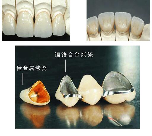 张家口麦格口腔：地址、营业时间、电话、牙种优惠价