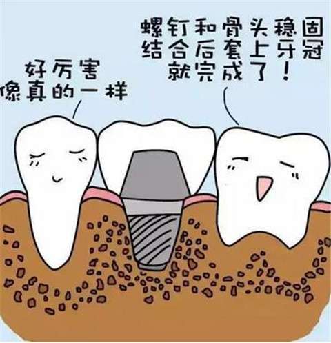 洛阳济仁口腔矫正牙齿价格如何？不拔牙做金属自锁只需多少费用