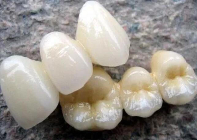 合肥美奥口腔：春季特惠！隐形牙齿矫正器享额外补贴