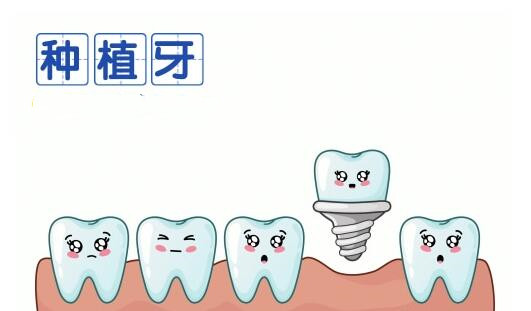 荆门小白兔口腔服务价格一览：拔牙、补牙、种植牙，9家分店通用