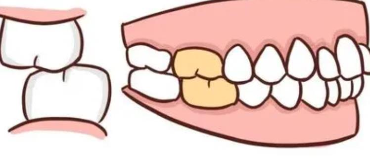 深圳口腔医院高效种牙，收费透明口碑好